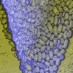 Bacteria Klebsiella pneumoniae (KP)