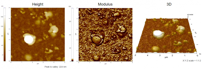 Protein_vesicles